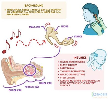 Why Do I Hear Music in My Ears: An Examination of Inner-Ear Perceptions